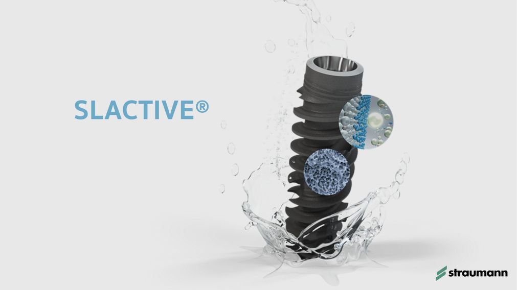 Implantes Straumann SLActive - Tecnologia suíça de osseointegração rápida em 3-4 semanas