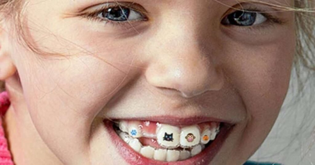 Invisalign First Infantil para Criança