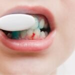 Gengiva sangrando ao escovar os dentes - causas e tratamento
