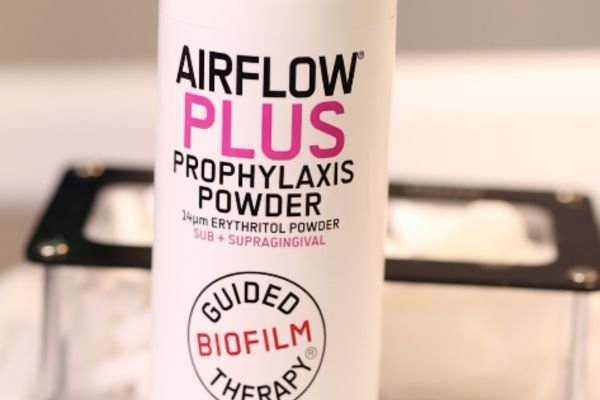 Raspagem Periodontal Dentista