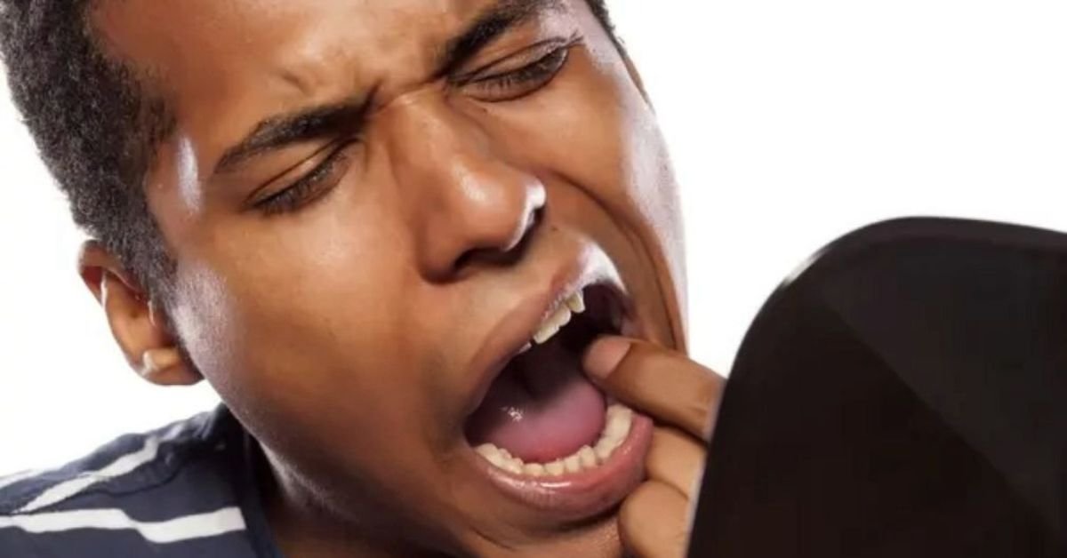 Pessoa preocupada descobrindo verruga na boca, sintoma de papiloma oral possivelmente causado por HPV