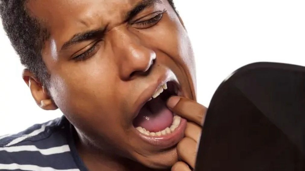 Verruga na Boca - Papiloma Oral - Descoberta e Preocupação Pessoa preocupada descobrindo verruga na boca, sintoma de papiloma oral possivelmente causado por HPV