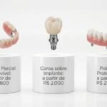 Preço da Prótese dentária em São Paulo SP