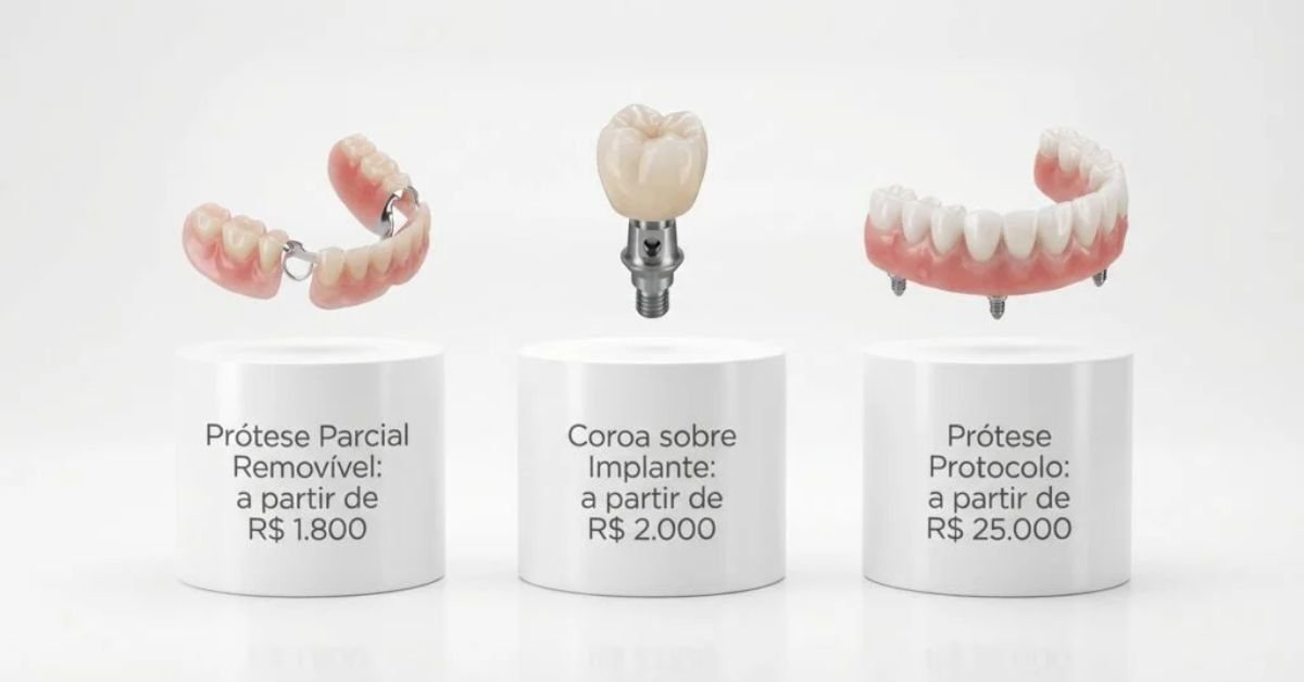 Preço da Prótese dentária em São Paulo SP