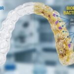 Como limpar o invisalign