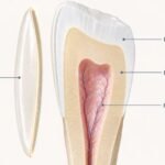 Lente de Contato Dental Estraga os Dentes A Verdade Sobre o Desgaste