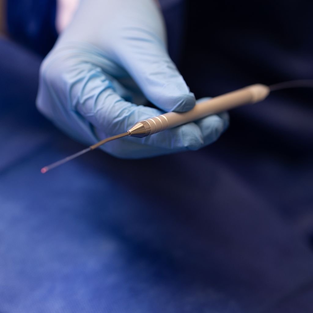 Cirurgia de frenectomia a laser de alta potência — Flori Odontologia