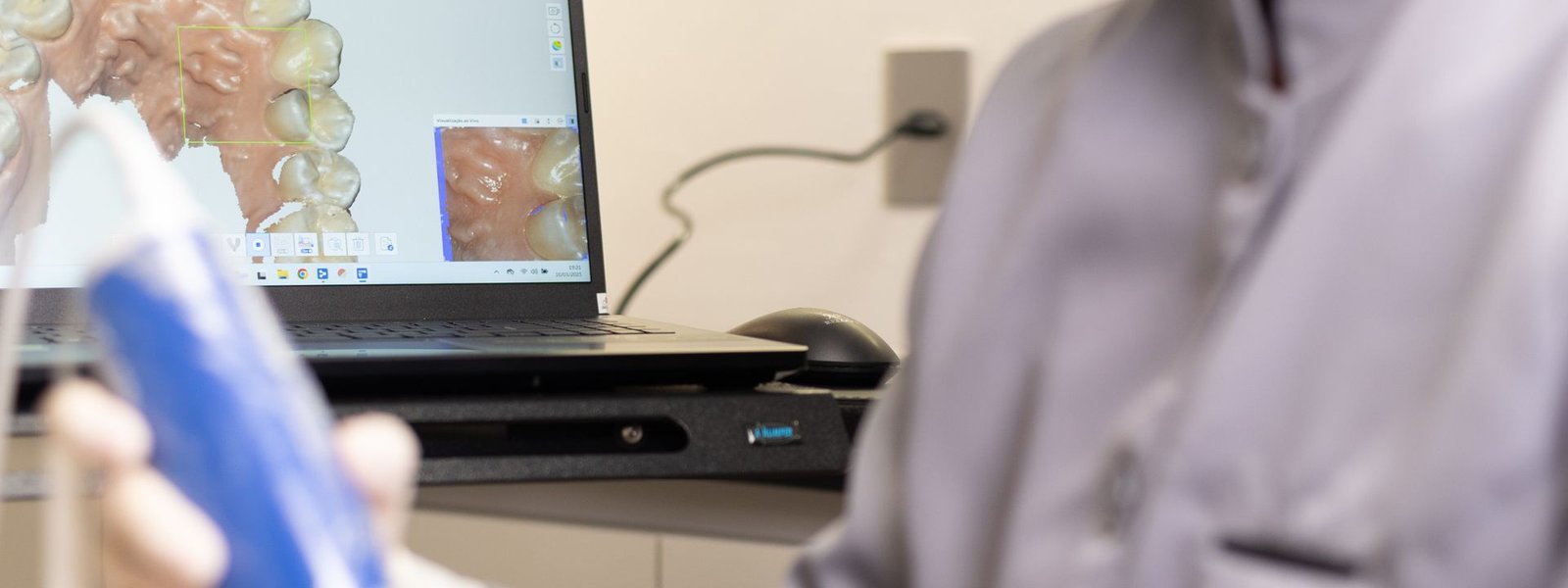 Dentista realiza escaneamento intraoral 3D para planejamento de implante dentário na Flori Odontologia