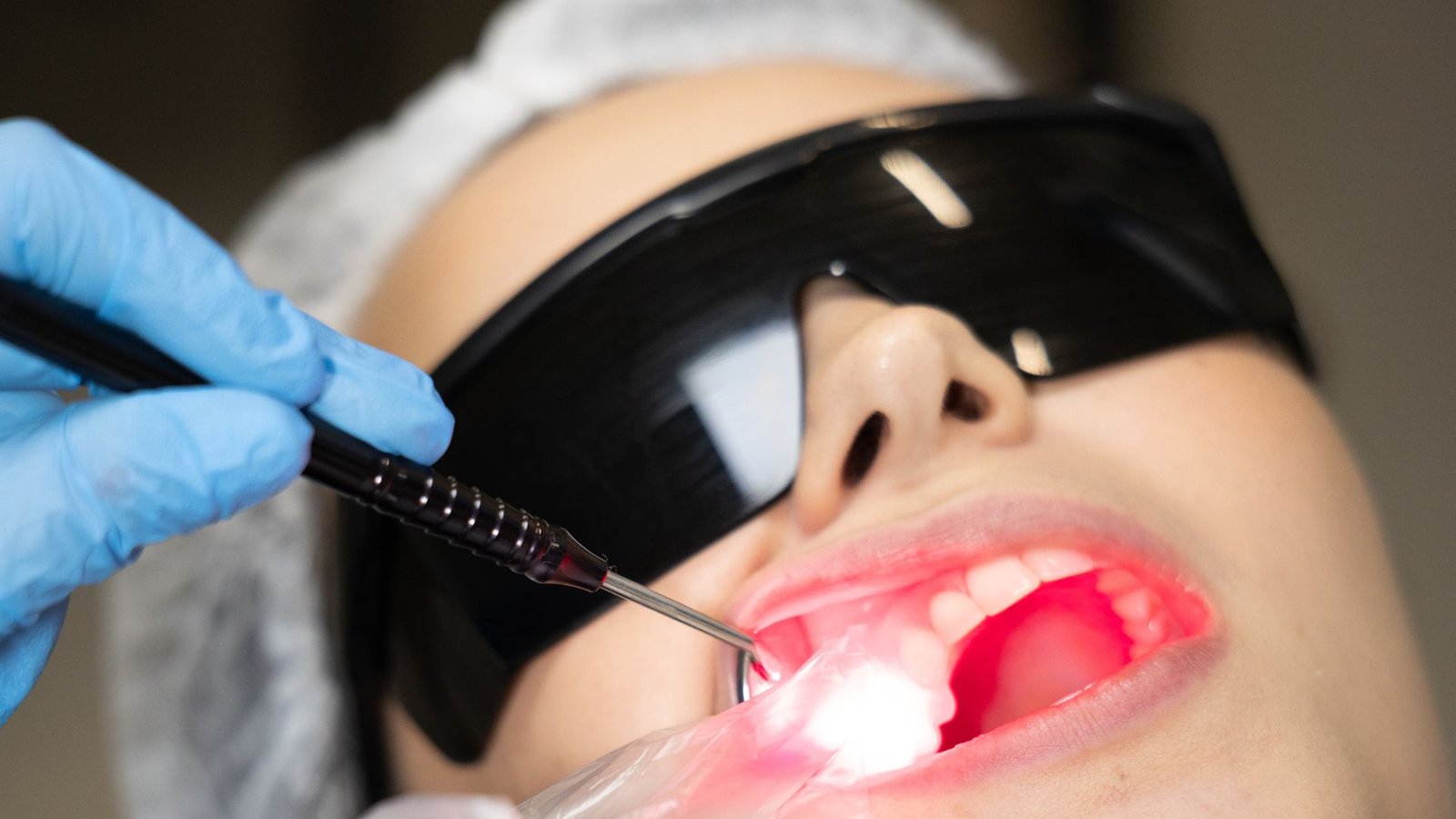 Laser de alta potência como recurso complementar em Endodontia na Flori Odontologia
