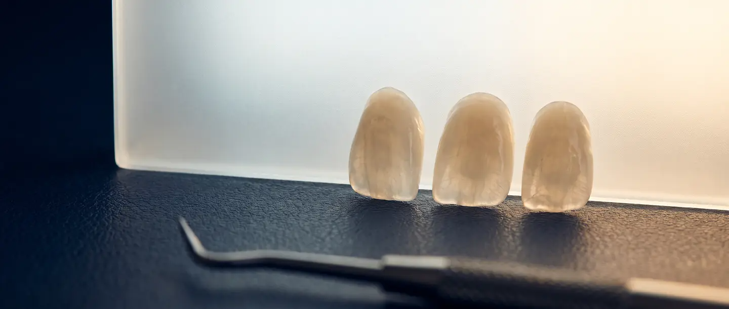 Laminados cerâmicos, guias de cor e instrumentos utilizados no planejamento de lentes de porcelana