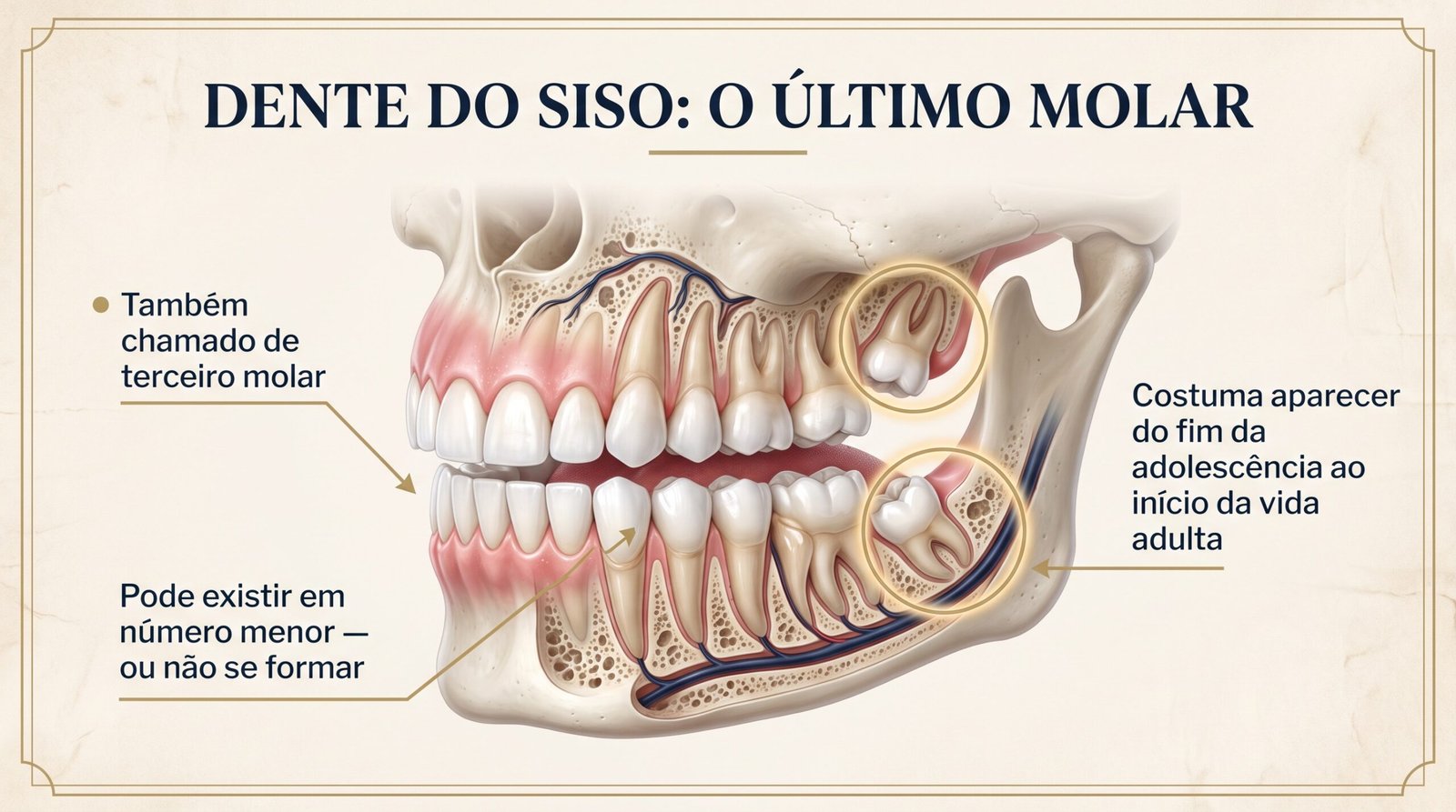 Dente do siso destacado no fundo das arcadas dentárias