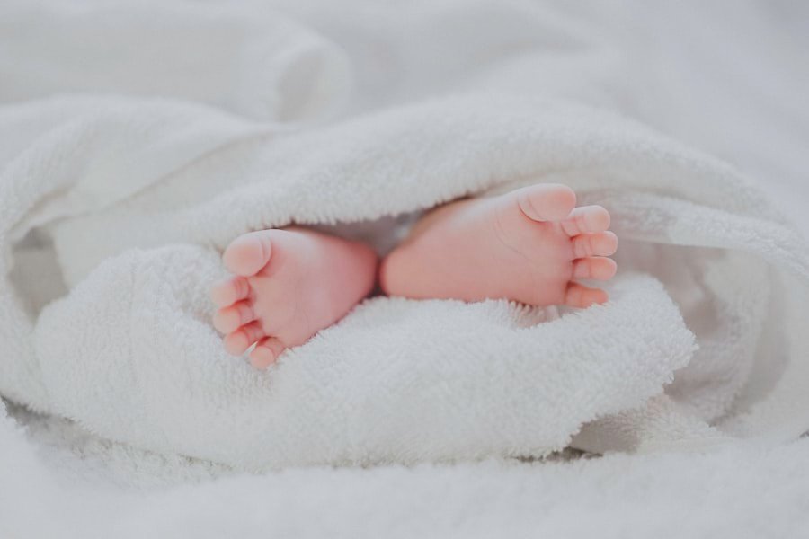 Bebê recém-nascido — frenectomia lingual para língua presa