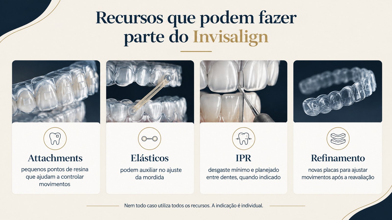 Infográfico sobre attachments, elásticos, IPR e refinamento no tratamento Invisalign