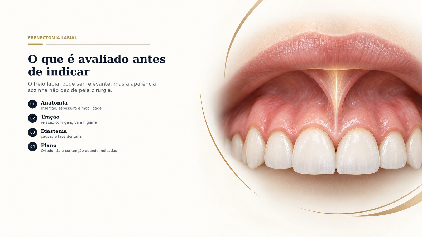 Imagem destacada do guia sobre frenectomia labial e lingual a laser