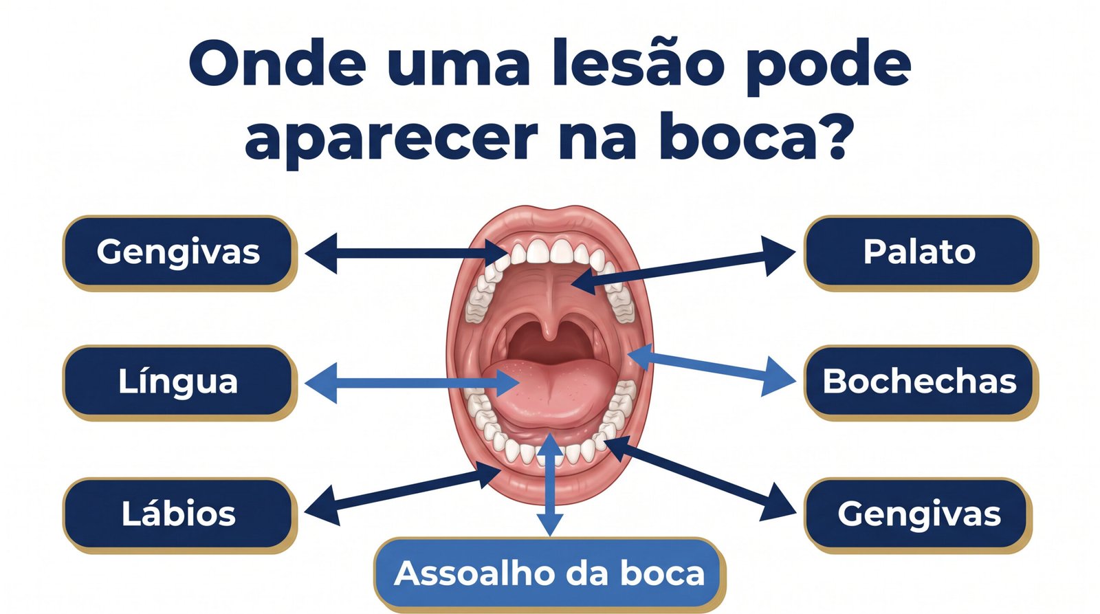 Infográfico anatômico das áreas da boca que podem fazer parte do exame clínico