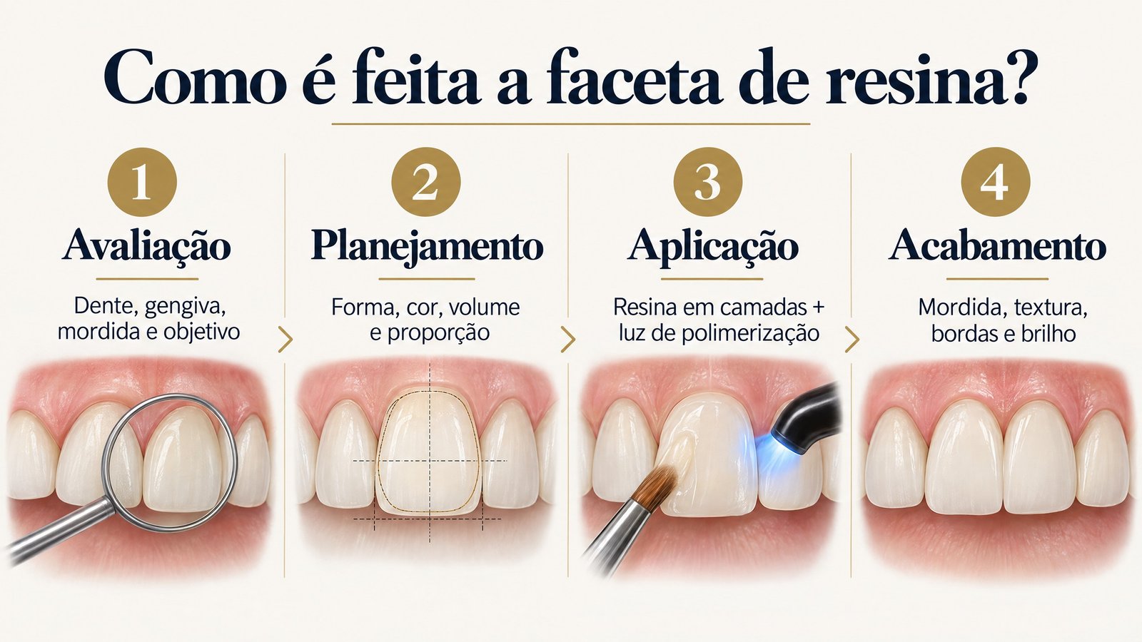 Infográfico mostra as etapas de avaliação, planejamento, aplicação da resina e acabamento.