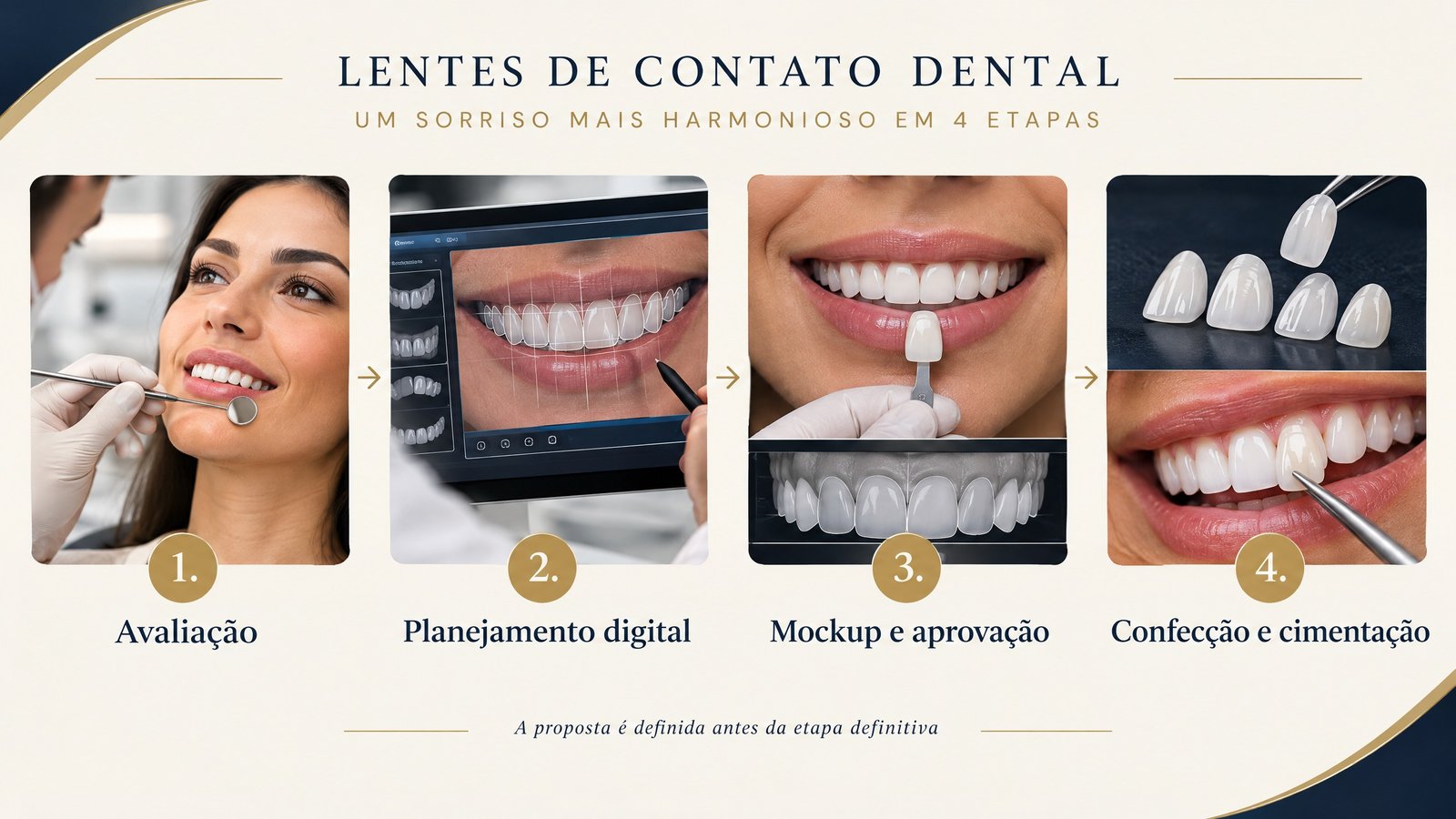 Infográfico com quatro etapas do tratamento com lentes de porcelana: avaliação, planejamento digital, mockup e aprovação, confecção e cimentação.